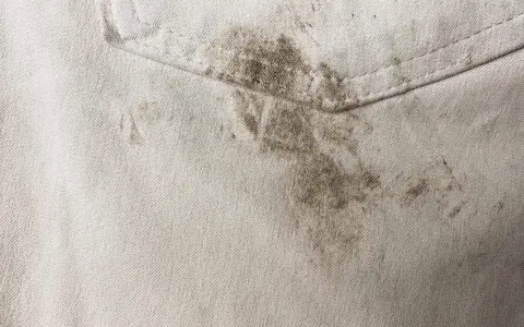 Schmutzige helle Hose mit dunklen Flecken. Tipps, wie man Fettflecken aus Kleidung entfernen kann, sind hier gefragt.